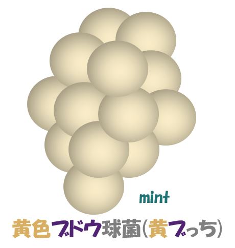 %e9%bb%84%e8%89%b2%e3%83%96%e3%83%89%e3%82%a6%e7%90%83%e8%8f%8c%e3%82%a4%e3%83%a9%e3%82%b9%e3%83%88